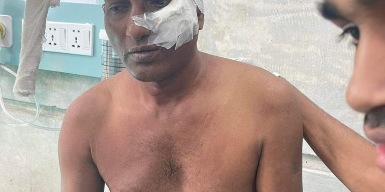 বিএনপির কেন্দ্রীয় কর্মসূচীতে গিয়ে গুরুত্বর আহত আইনজীবী