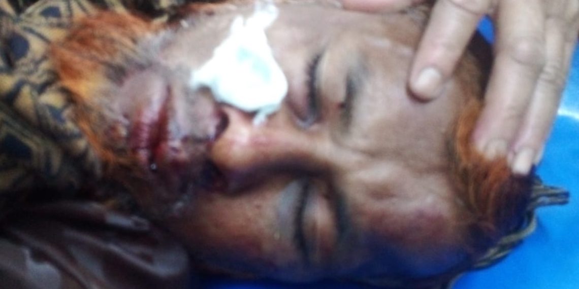 চাদার দাবীতে হাতুরি পেটা, আটক-৩