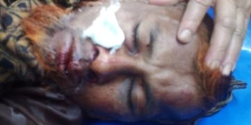 চাদার দাবীতে হাতুরি পেটা, আটক-৩