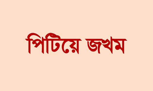 গলাচিপায় বাকিতে সিগারেট না দেওয়ায় ব্যবসায়ীকে পিটিয়ে জখম