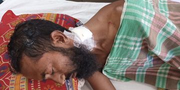মামলায় সাক্ষী হওয়ায় মহিপুরে যুবককে কুপিয়ে জখমের অভিযোগ