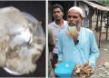 দুমকিতে কথিত কবিরাজের অলৌকিক চিকিৎসা, স্বাস্থ্যঝুঁকির আশঙ্কা