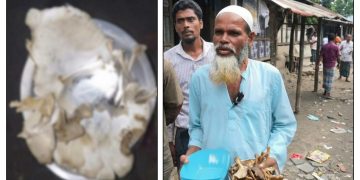 দুমকিতে কথিত কবিরাজের অলৌকিক চিকিৎসা, স্বাস্থ্যঝুঁকির আশঙ্কা